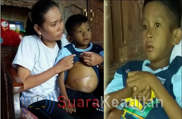 Perut Buncit Karena Kista Hati, Dek Yuda butuh uluran tangan kita