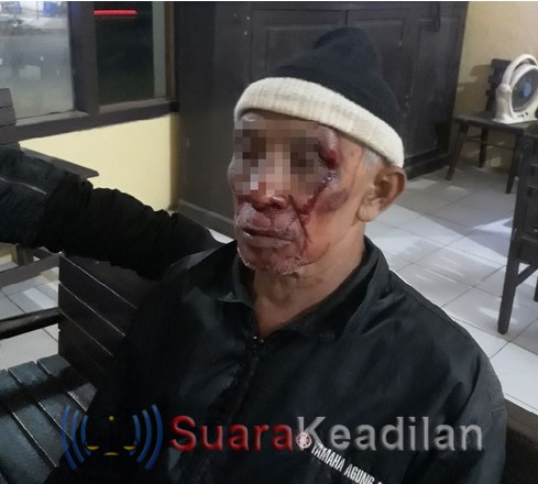 Tidak Terima Ditegur, Seorang Pemuda Pukul Kakek Hingga Berdarah-Darah